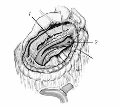 ���� �������� ���������� ������������ �����������������������