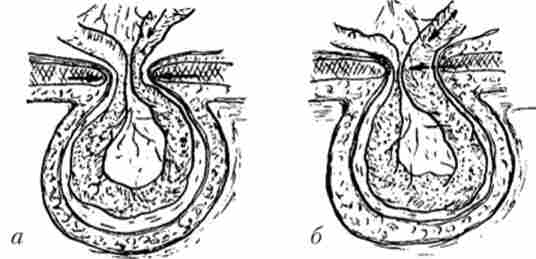 ���� ��������� ����