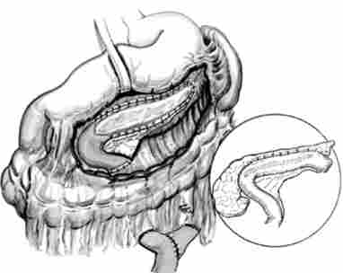 ���������� ������ �������� ���������� ������������ ����������������������� (�������� �������-�)