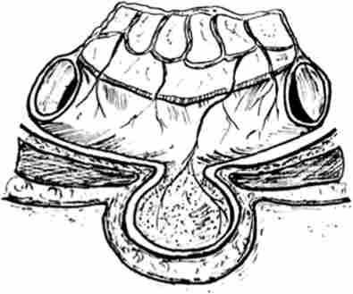 ������������ ��������� �����