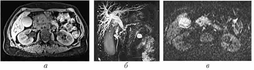 ��� ������� ���������� ������