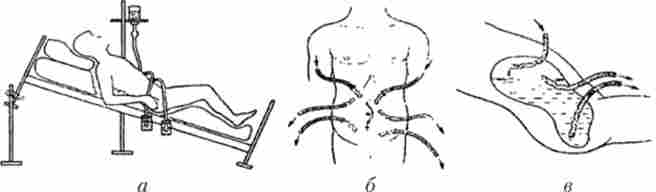 ���������� ������� ��������� ��� ���������