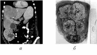 ��������� �������� �������