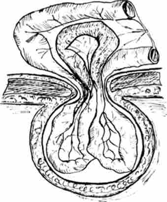 ������������ (VT-�������, ��������) ���������