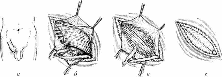 �������� ������ ����� �������� ������ �� �������