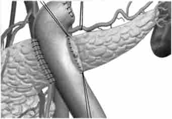 ��� ������������� ���� ��������� �������� ���������� ������