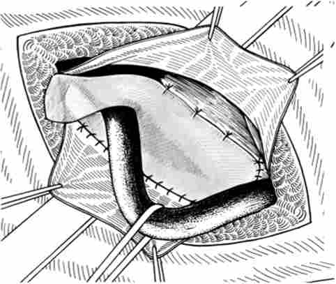 �������� �������� ������ �� ˳����������