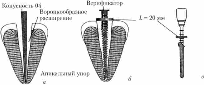 ����������� ���������� ������, ������� Thermafil [27]
