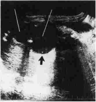 ������������� ����������. ���������� ���������� ������