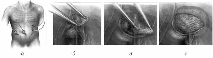 ���������������� ������������� ���������� �������������