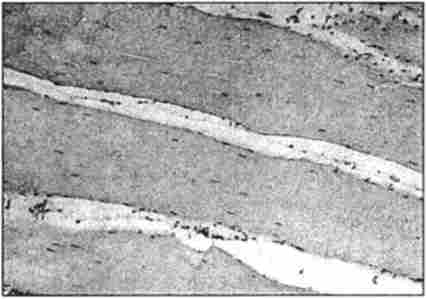 ̳������������ �'��� �������. ����������� ������������� � �������