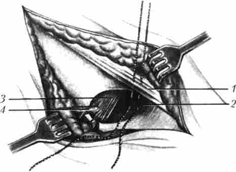 �������� �������� ���� �� �������