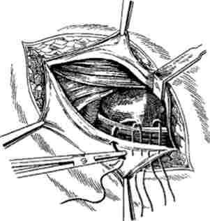 �������� �������� ���� �� ���� - �����������