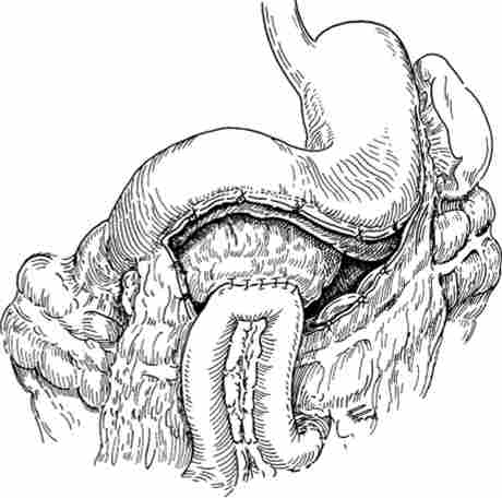 ���������� �������������������