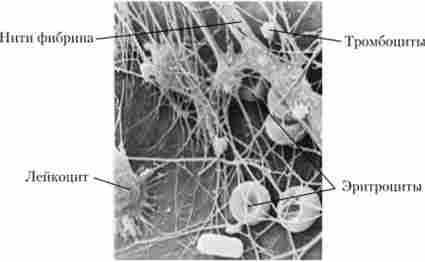 ����� (���������� �������� ���������)