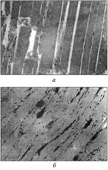 ̳������������ ���������, ���������������� ������������ ��������� Yersinia enterocolitica. ����������� ������������� � �������, ������ �7