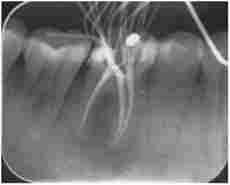 ������������� ���� 4.6. �������� ����������� ������������� �������� ��������� ������