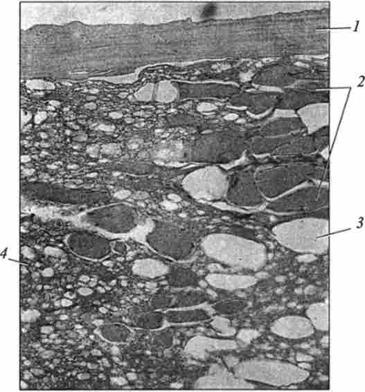 ̳������������ ������ �������. ����������� ������������� � �������