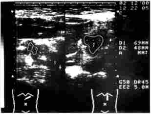 ������������� ����������