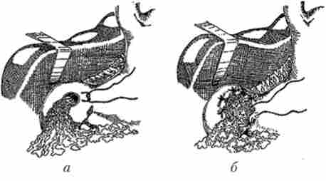 �������� ������������ ������� ��������� ����� ������ �� ����� - ����������