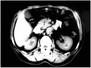 ����'������ ����������. ��� ������� ���������� ������