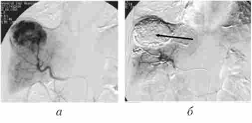 ��������� ������� ������ ���