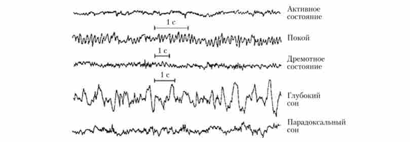 �������������������� � ��������� �������������� ������ ��������� - ��� ������� �� ��������� �������� �� ������ � ���