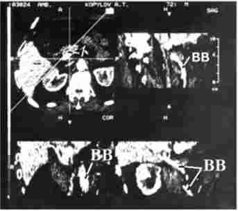 �������� ����'������ ���������� � ������������