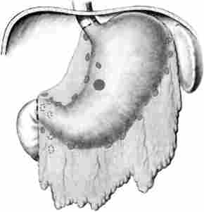 ����� �������� ��� �������� ������