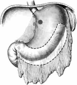 ����������� ������������ �������� ������. ����� ��������