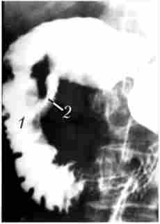 ������������� � ������ ��������