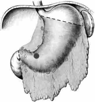 ������������ ���������� �������� ������. ����� ��������