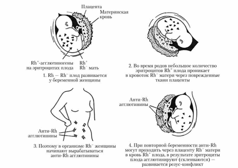 ����������� �����-�������