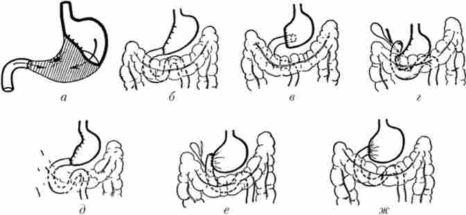������� �������� �� ��������� �������-1