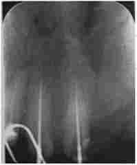 ³��������. ������� �., 67 ����, �����������