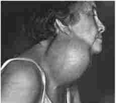 ��������� ���