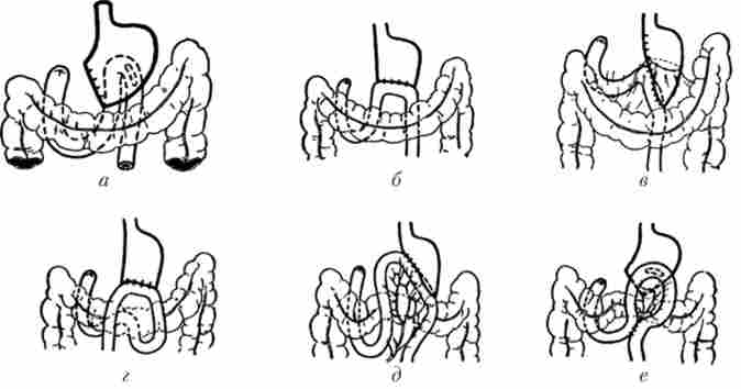������� �������� �� ��������� �������-�