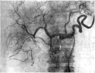 ������������. ��� ������� ���������� ������