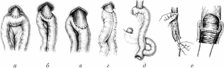 ������� ���� ���������������������