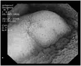 �������� ��� ���������� ������� �������� � ������������ ������ �������ﳿ