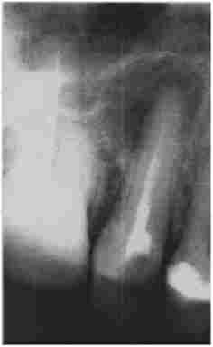 �������� ��������. ������