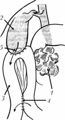 ���������������������� � ���������� ���������� ��� ������