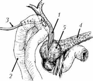 ����� �������� ���������� ��������� �������������������� ��� ���� ������� ���������� ������, ������������ ���������� ����������