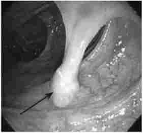 ������������� ���� ���������� ����� �� ����� (��������������ﳿ)