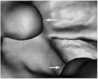 ���� ������ ����� (��������� �����������)