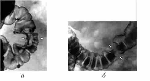 �������������� ������� ���� ������� �����