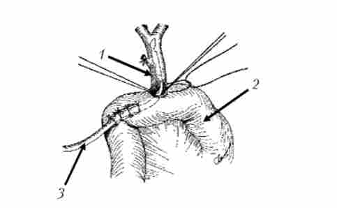 ���������������� ���� ���. ���������� ����������������������