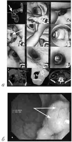 ����������� ����� ������� �����