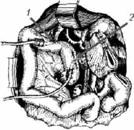 ���������- � ��������������������� ���������� �� ��������