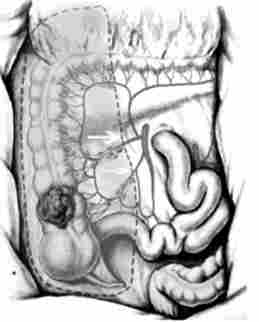 ����� �������� (��������������� ������������) ��� ���� ���� � �������� ������� �����. �������� �������� �������� ������� ������